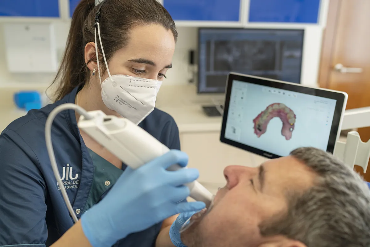 Análisis de la sonrisa