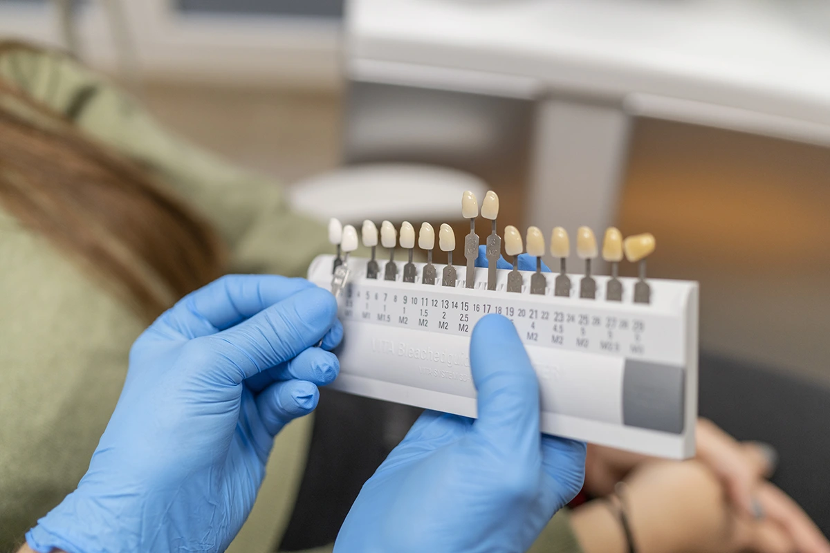 Tipos de blanqueamiento dental