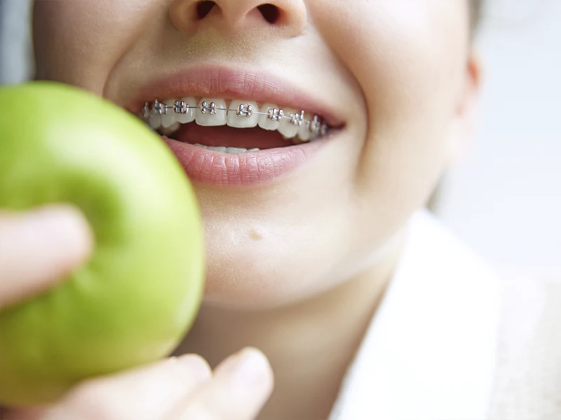 Alimentación adecuada dental