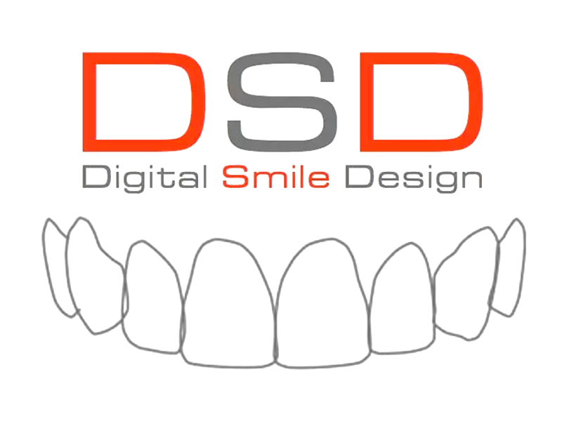 Digital Smile Design