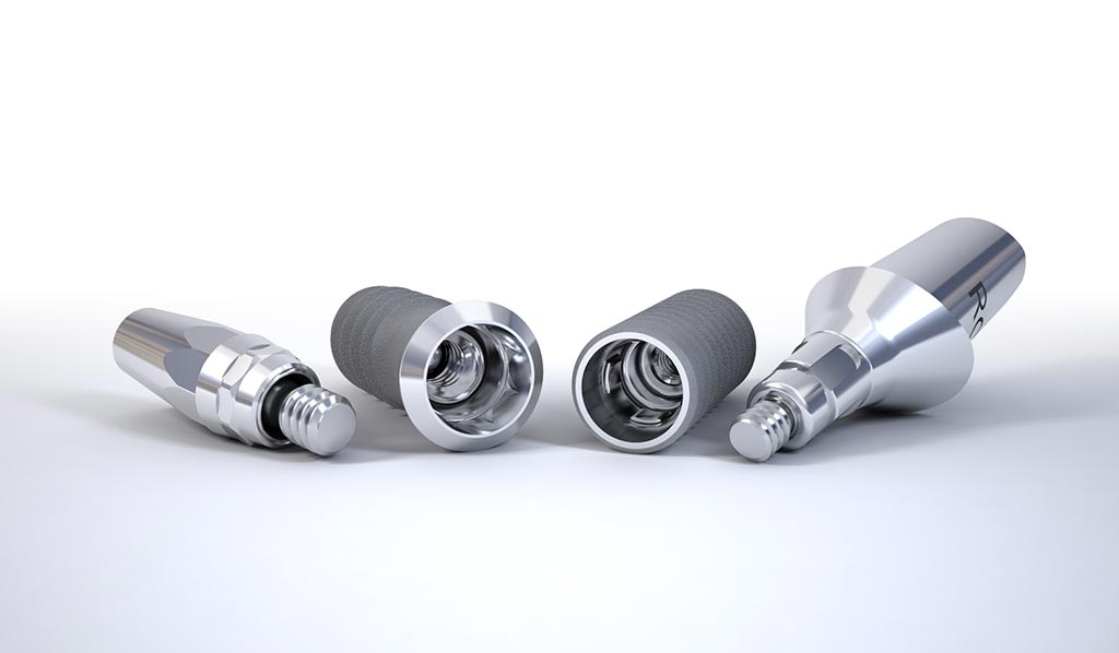 Materiales de los implantes dentales