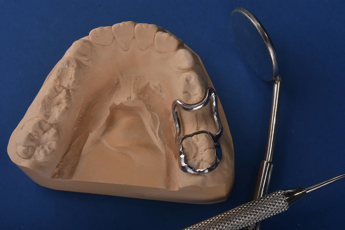 Mantenedor de espacios