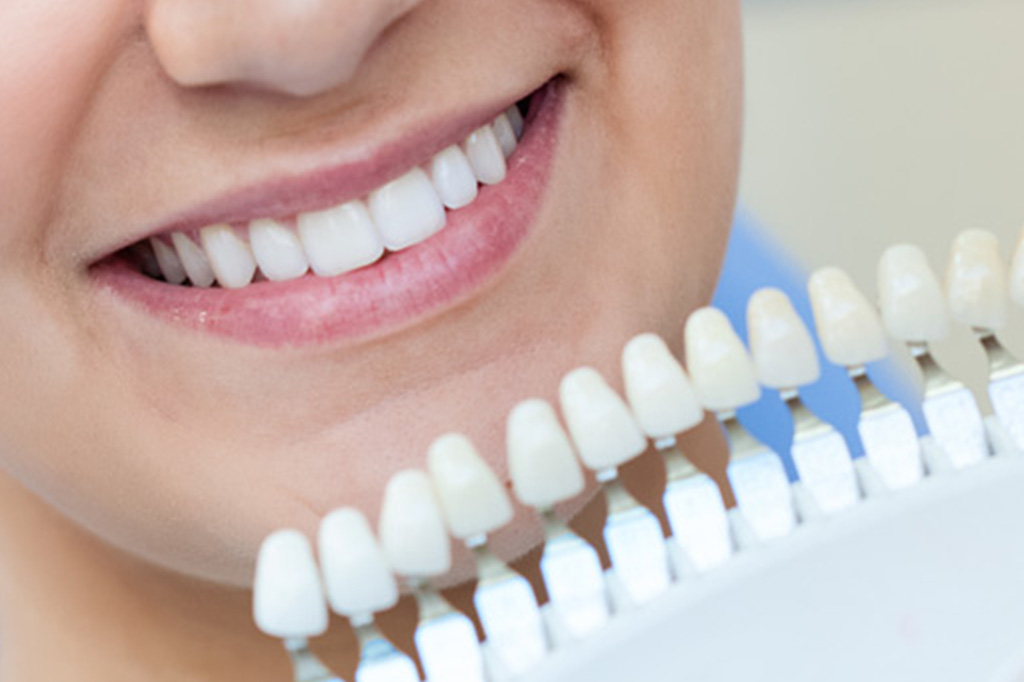 Medición de blanqueamiento